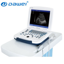 new handheld ultrasound scanner & portable ultrasound for pregnancy